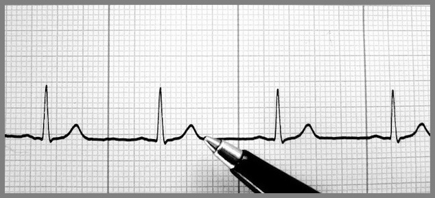 problemes cardiaques 